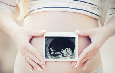 ultrasound photo of fetus